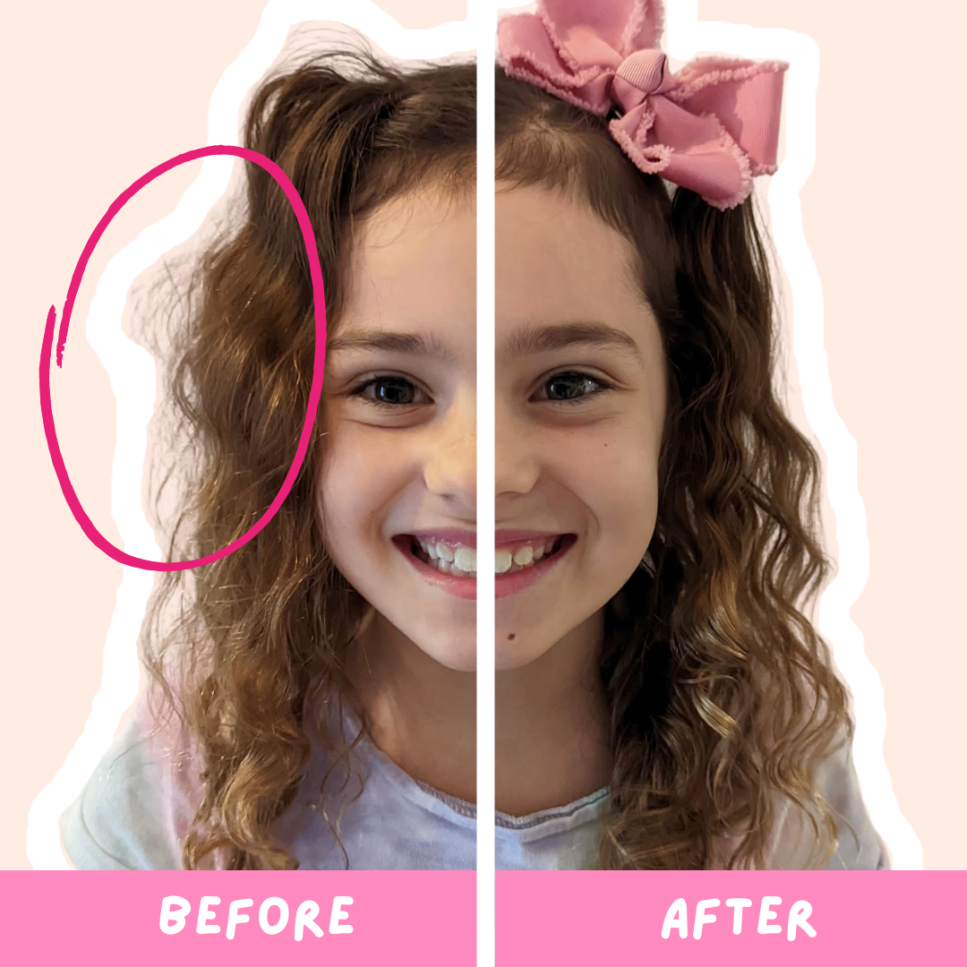knotty-hair-befor-and-after-girl